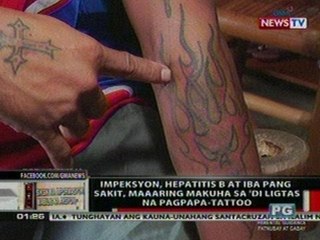 OC: Impeksyon, hepatitis B at iba pang sakit,   maaring makuha sa di ligtas na pagpapa-  tattoo