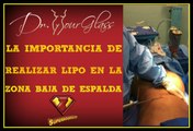 La importancia de realizar liposucción en la zona baja de la espalda y flancos durante una abdominoplastia