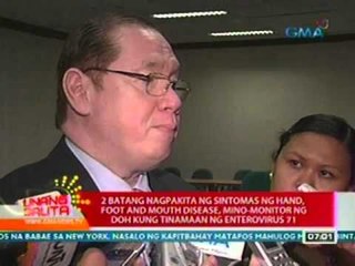 UB: DOH: Enterovirus 71, posibleng maging sing-seryoso ng polio virus