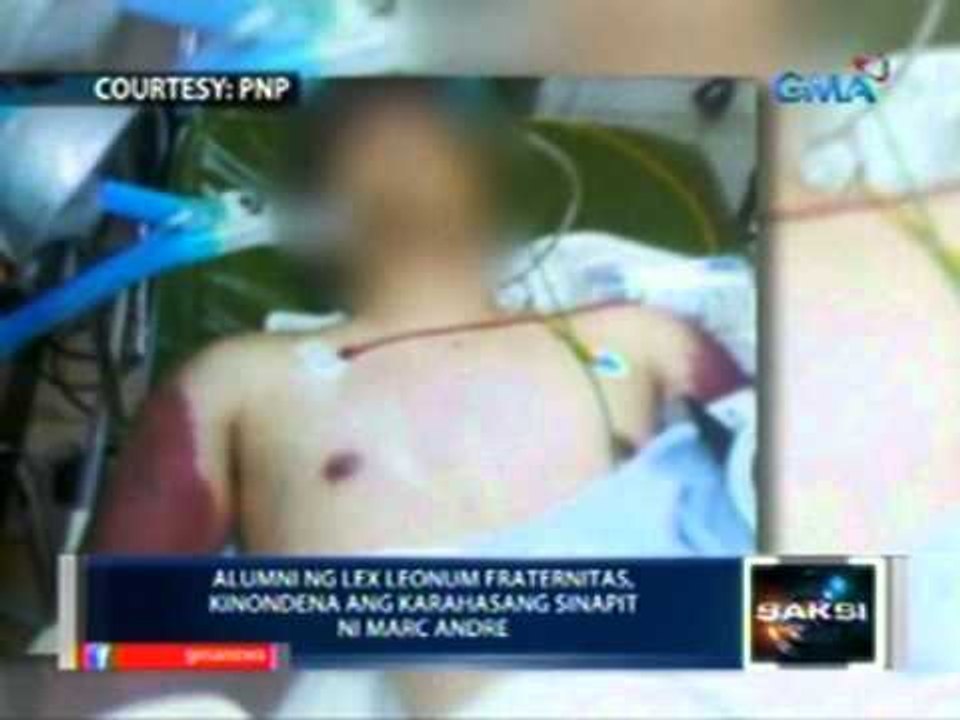 Saksi: 2 neophyte na kasama umano   ni Andre sa initiation rites,   hirap maglakad ngayon