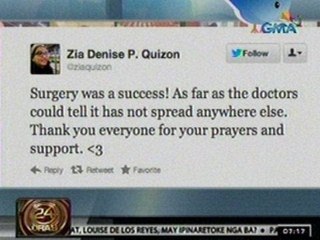 24Oras: Surgery ni Zsa Zsa Padilla sa Amerika, matagumpay