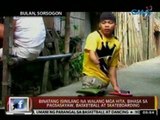 24 Oras: Binatang isinilang na walang   mga hita, bihasa sa pagsasayaw, basketball at skateboarding