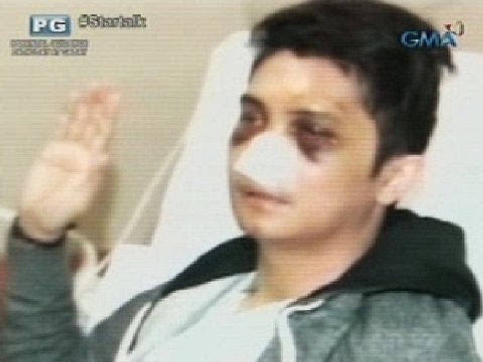 Startalk: The Vhong Navarro case: Timeline of events