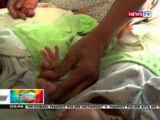 BP: Bata sa Gensan, isinalang nang walang paa at isang kamay