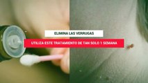 Tienes Verrugas? Solo Aplica Este Tratamiento Natural Y Eliminalas Para Siempre