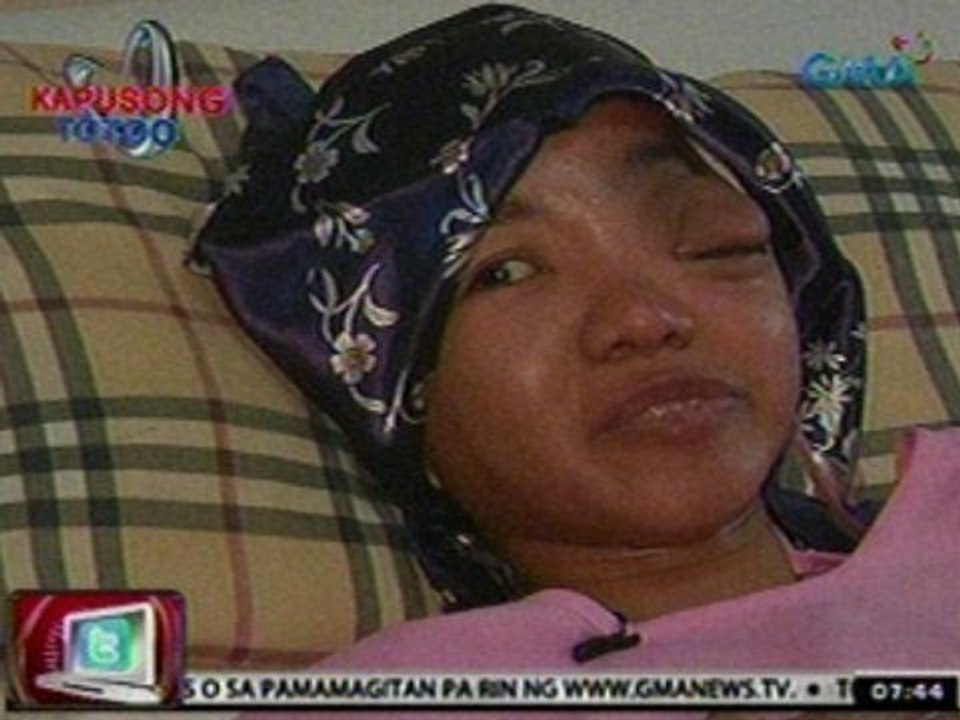 24Oras: Ginang na 20 taon nang iniinda ang malaking bukol sa mata, sumailalim sa operasyon
