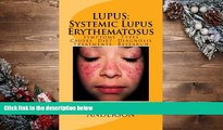 Audiobook  LUPUS:  Systemic Lupus Erythematosus: Symptoms. Types. Causes. Diet.  Diagnosis.