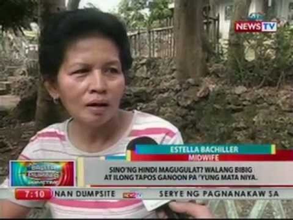 BP: Sanggol sa Bangued, Abra, ipinanganak ng walang ilong at bibig at iisa lang ang mata