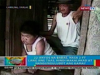 BP: 22-anyos na babae na 2-ft lang ang taas, nanawagan ng tulong