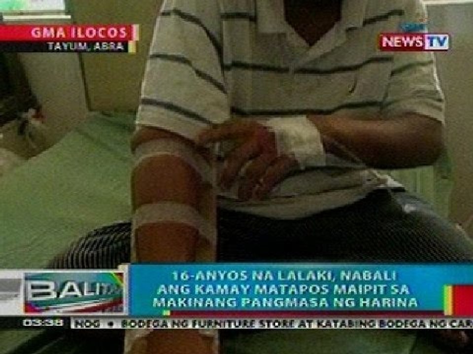 BP: 16-anyos na lalaki, nabali ang kamay matapos maipit sa makinang pangmasa ng harina