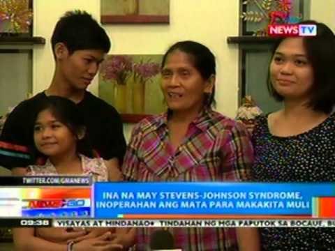 NTG: Ina na dinapuan ng stevens-johnson syndrome, hindi nakita ang paglaki ng tatlong anak