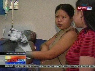 NTG: DOH: Mga biktima ng paputok, umabot na sa 72