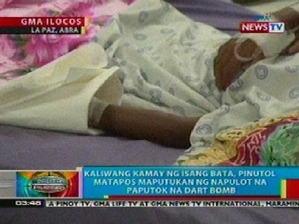 BP: 8-anyos na lalaki, naputulan ng kamay matapos maputukan ng dart bomb