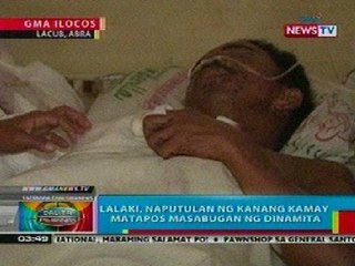 BP: Lalaki, naputulan ng kanang kamay matapos masabugan ng dinamita