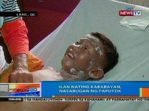 NTG: Ilan nating kababayan, nasabugan ng paputok