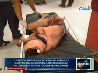 Saksi: 413 naputukan at tinamaan ng ligaw na bala sa pagsalubong sa 2013, mas mababa noong 2012