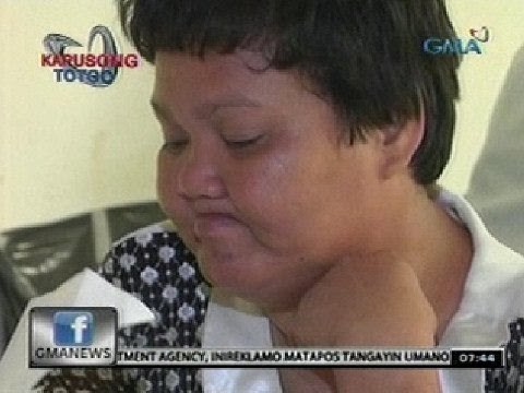 24 Oras: 97, mabibigyan ng bagong pustiso sa Ngiting Kapuso Project ng Kapuso Foundation