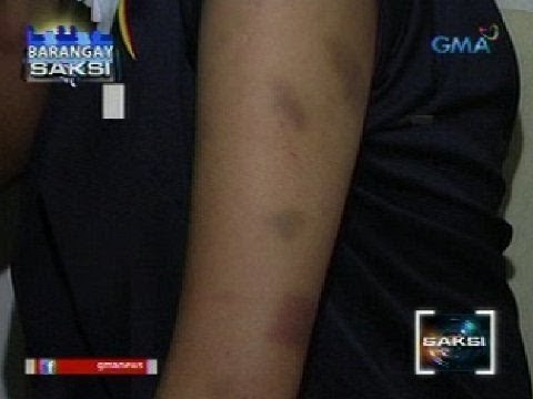 Saksi: Maraming babae, biktima pa rin ng pang-aabuso sa tahanan