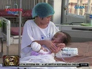 24Oras: Magulang ng batang babaeng naputulan ng 2 paa matapos itong malapnos, nananawagan ng tulong