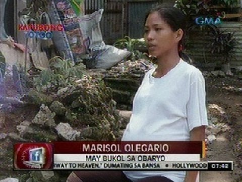 24 Oras: Babaeng tila buntis dahil sa ovarian cyst, nananawagan ng tulong medikal
