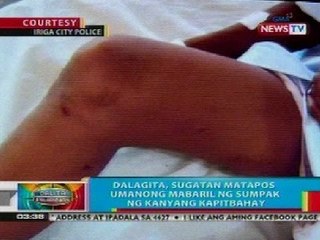 BP: Dalagita sa Iriga City, CamSur, sugatan matapos mabaril ng sumpak ng kanyang kapitbahay