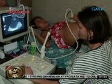 24 Oras: Babaeng tila buntis dahil sa ovarian cyst, matagumpay na sumailalim sa operasyon