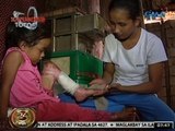 24Oras: Magulang ng batang nalapnos ang buong kaliwang paa, nananawagan ng tulong medikal