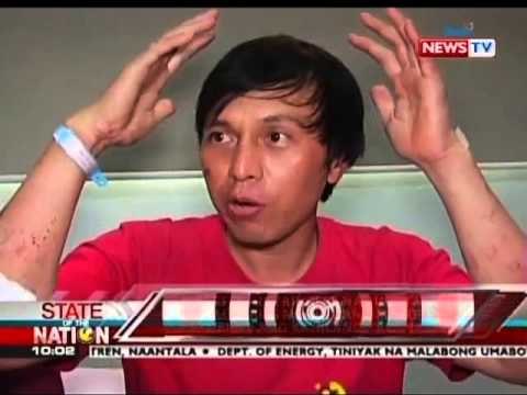 SONA: Ilang nailigtas mula sa Bulkang Mayon, ikinuwento ang kanilang karanasan sa phreatic explosion