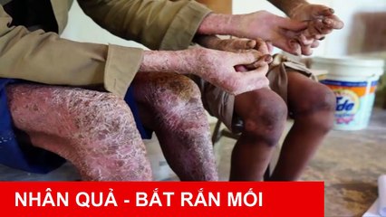 ☀Chuyện Nhân Quả Báo Ứng☀ BẮT RẮN MỐI