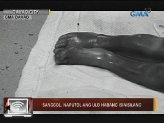 24 Oras: Sanggol, naputol ang ulo habang isinisilang