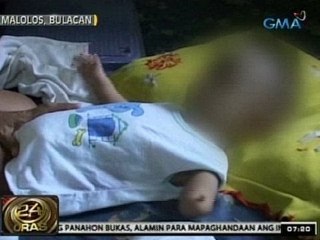 24Oras: Sanggol na walang isang kamay, dalawang paa at ari, kinupkop ng isang ginang