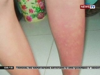 SONA: Outbreak ng chikungunya at dengue, naitala sa Patnongon, Antique