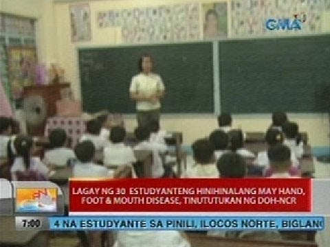 Lagay ng 30 estudyanteng hinihinalang may hand, foot & mouth disease, tinututukan ng DOH-NCR