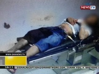 BT: Mister sa Pasay, pinutulan ng ari ng misis dahil umano sa selos