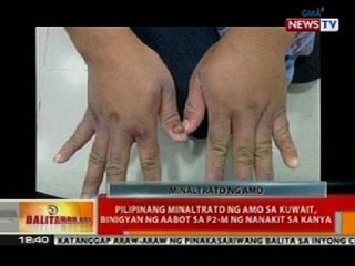 BT: Pilipinang minaltrato ng amo sa Kuwait, binigyan ng aabot sa P2-M ng nanakit sa kanya