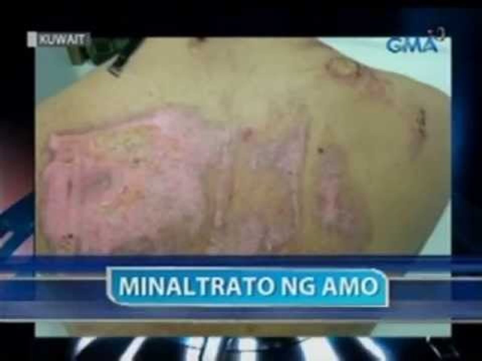 Saksi: Minaltratong Pilipinang kasambahay sa Kuwait, tatanggap ng P2-M danyos