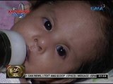 Sanggol, pinahihirapan ng malnutrisyon; kape mula sa tinustang bigas, karaniwang pagkain ng bata