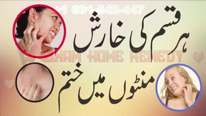 Chehre Ki Kharish Ka Ilaaj | Cure Allergy Naturally