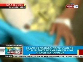 BP: 12-anyos na bata sa Abra, naputulan ng 3 daliri nang masabugan ng hinagis na paputok