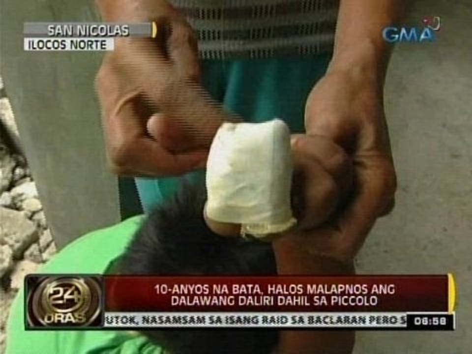 24 Oras: Sampung-taong gulang na bata, halos malapnos ang 2 daliri dahil sa piccolo