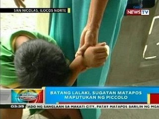 Batang lalaki sa San Nicolas, Ilocos Norte, sugatan matapos maputukan ng piccolo