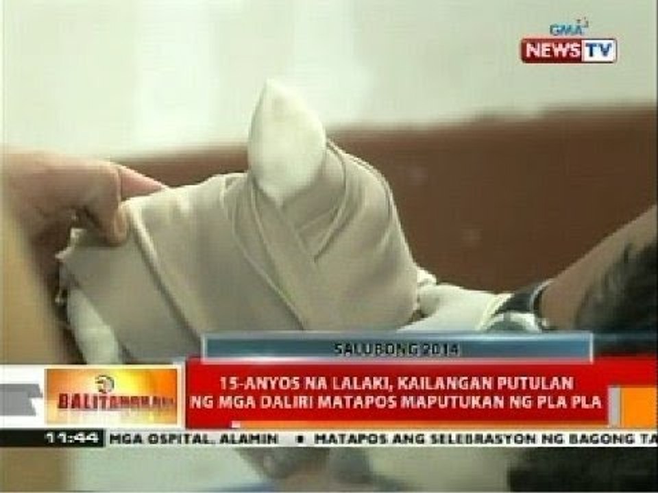 BT: 15-anyos na lalaki, kailangan putulan ng mga daliri matapos maputukan ng pla pla