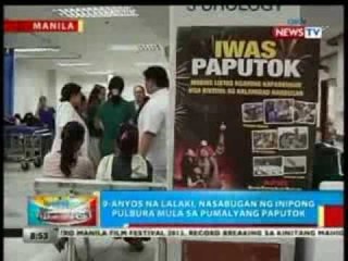 BP: 9-anyos na lalaki, nasabugan ng inipong pulbura