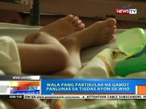 NTG: Wala pang partikular na gamot panlunas sa tigdas ayon sa WHO