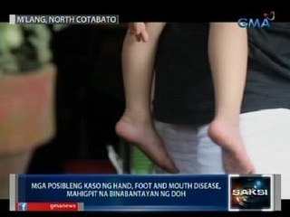 Saksi: Mga posibleng kaso ng hand, foot and mouth disease, mahigpit na binabantayan ng DOH