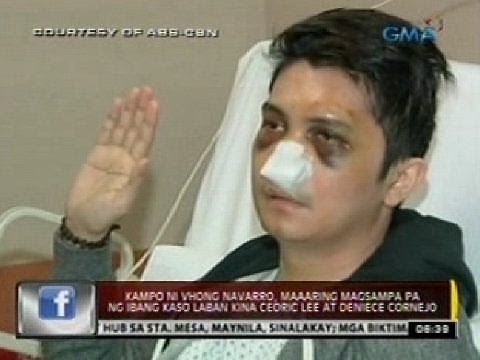 Kampo ni Vhong, maaaring magsampa pa ng ibang kaso vs Cedric Lee at Deniece Cornejo