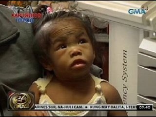 24 Oras: Babaeng may problema sa thyroid, nananawagan ng tulong medikal