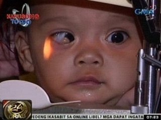 Kapusong Totoo: Pamilya ng sanggol na may "Goldenhar Syndrome," nananawagan ng tulong