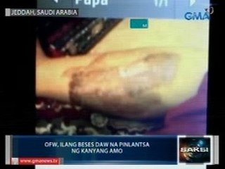 SAKSI: OFW sa Saudi, ilang beses daw pinlantsa ng kanyang amo
