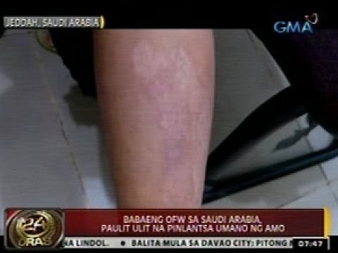 Babaeng OFW sa Saudi Arabia, paulit-ulit na pinlantsa umano ng amo